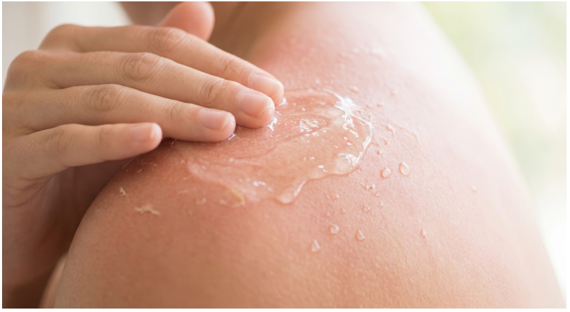 Aloe Vera After-Sun-Pflege